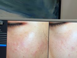 -苑苑vbeauty科技美容SPA