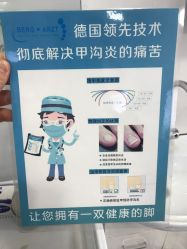 -德哥灰指甲脚气甲沟炎跖疣护理