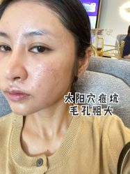 体验前-南京康美美容医院·旗舰店