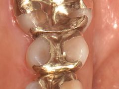 -精德口腔·种植修复·儿牙中心(财富中心店)