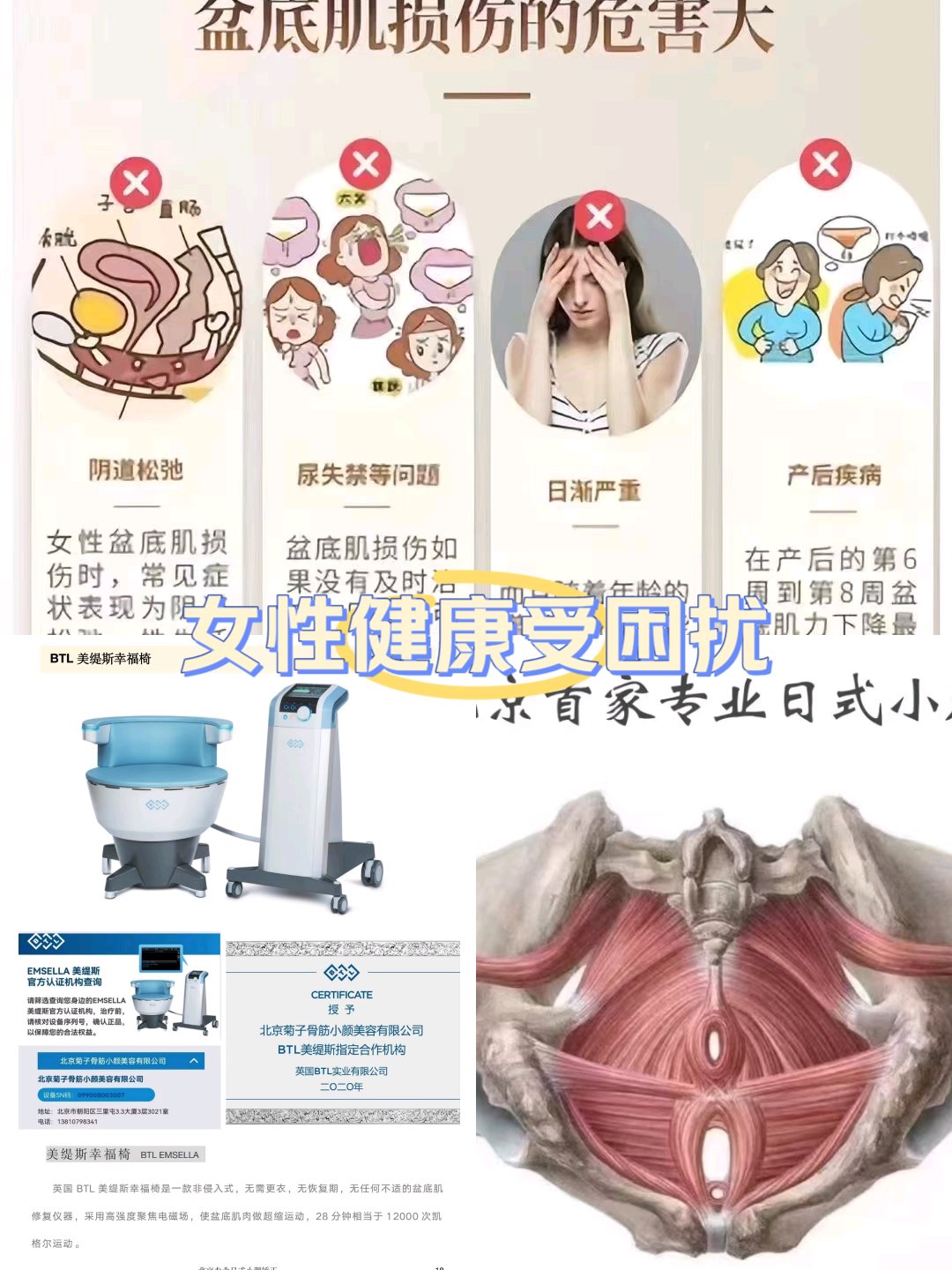盆底肌修复的重要性!