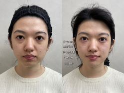 -素美医疗美容·西南眼鼻整形·修复基地