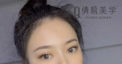 -倩极·精研痘敏肌管理