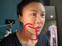 -上海仁爱医院