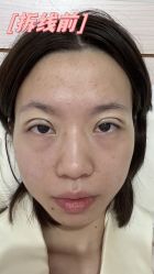 -素美医疗美容·西南眼鼻整形·修复基地