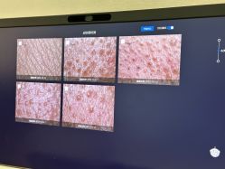 -悟空祛痘·诺奖技术专业店