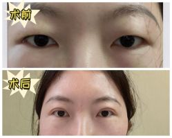-素美医疗美容·西南眼鼻整形·修复基地