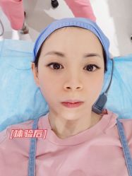 体验后-广东韩妃整形外科医院