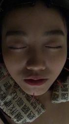 -肥三针腧穴瘦身馆