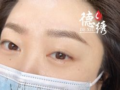 -德绣·机器野生眉发际线·美瞳线半永久