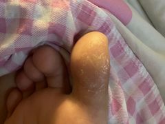 -新甲连锁灰指甲·甲沟炎·修脚(爱联店)