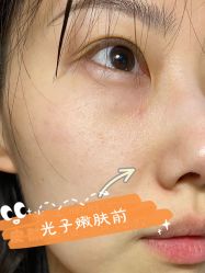 点击看大图 体验前-坤如玛丽·医疗美容中心