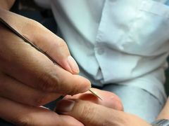 -新甲连锁灰指甲·甲沟炎·鸡眼(黑龙江路店)