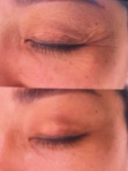 -郡艺医疗美容·微整·眼鼻吸脂