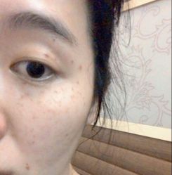 点击看大图 -SKINIST丽铂医疗美容