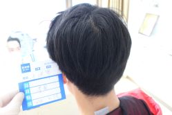 -大麦微针植发丨全国连锁