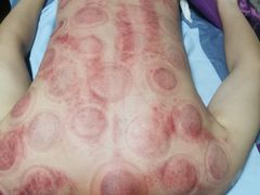 -沈师傅盲人按摩工作室(密三小区店)