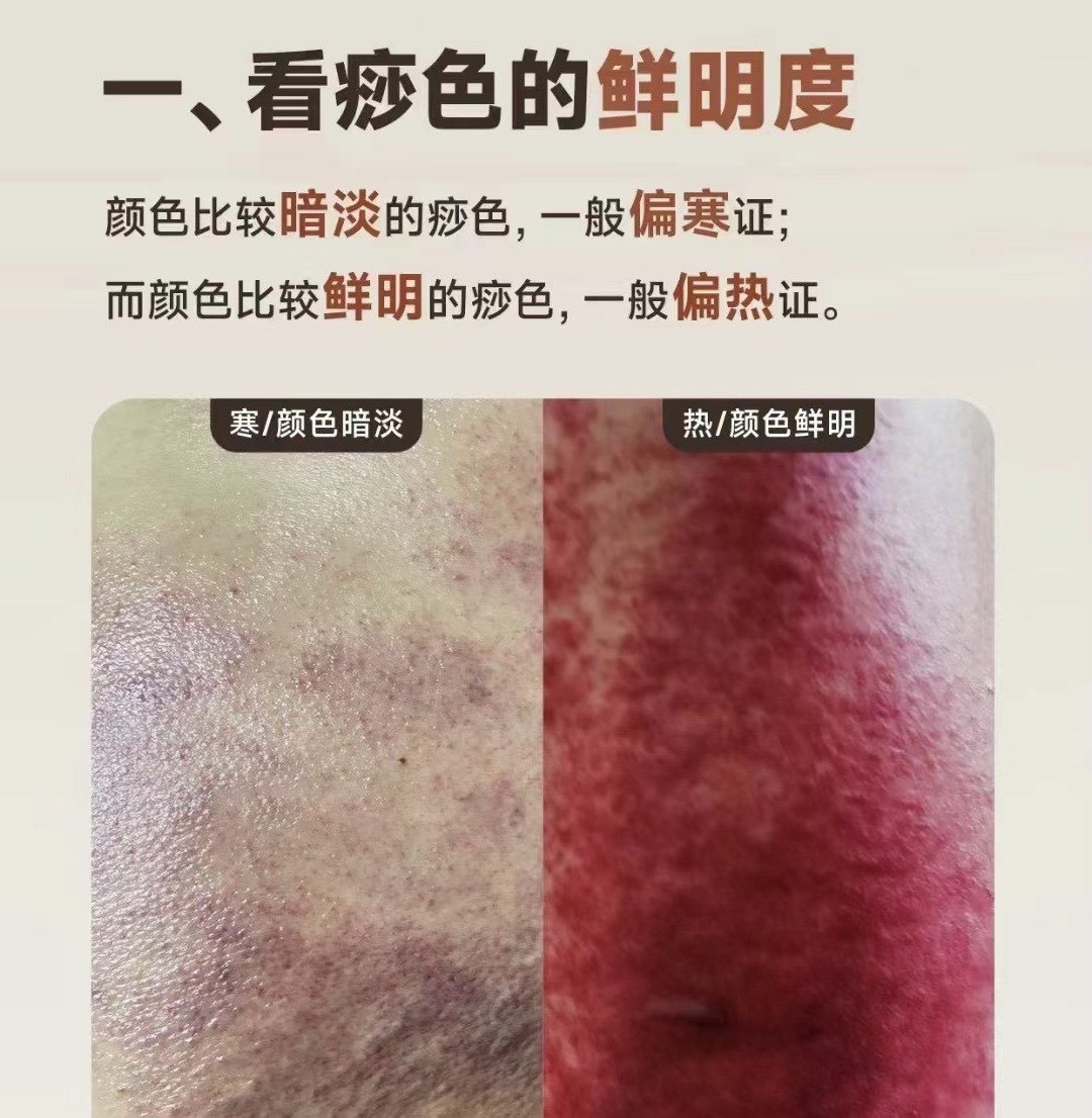 痧-大众点评