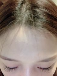 -宥莉·ULLY 痘敏肌•科技皮肤管理中心