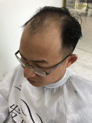 -发饰美男士增发补发假发定制店