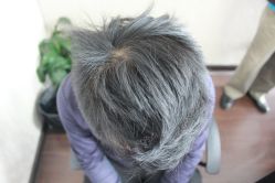 点击看大图 -大麦微针植发丨全国连锁