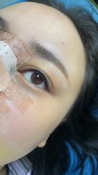 点击看大图 体验后-重庆联合丽格第五医疗美容医院