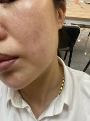 -上海玫瑰医疗美容医院