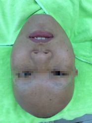 -苗医生草本科技祛痘