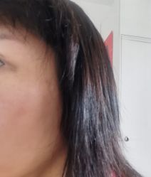 -More摩尔医美の注射线雕光电中心