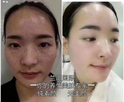 -兰派国际美容养生SPA