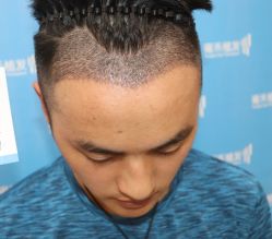 -雍禾植发全国连锁