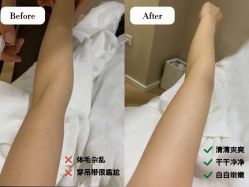 -中科妍美专业脱毛美肤连锁机构