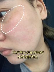 -西安壹加壹医疗美容·西北抗衰旗舰店