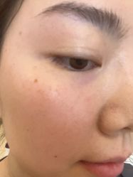 -长沙雅美医疗美容医院