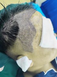 -熙朵美学植发·连锁品牌