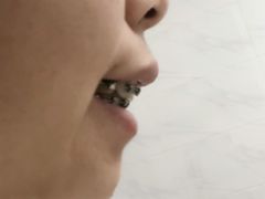 -柏乐口腔(南宁总院)