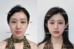 -Yestar重庆艺星医疗美容医院