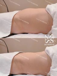 -Fundi张玉珊修身堂·indiba·BTL科技瘦身