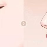 塌鼻子如何变立体？【案例详解】