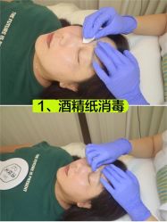 -清疣美疣·痣·斑净肤中心