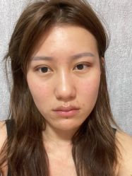 -杭州奥拉克医疗美容门诊部