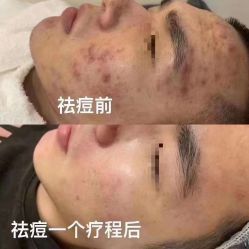-痘庄科学祛痘国际连锁