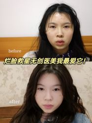 -深圳美莱医疗美容医院