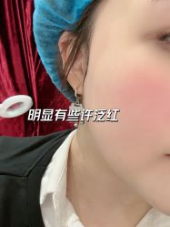 体验前-武汉颜范薇美医疗美容门诊部