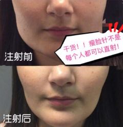 -厦门美莱整形美容医院