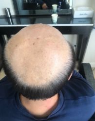 -唐风采假发补发定制
