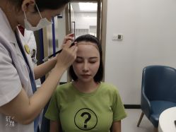 -大麦微针植发全国连锁