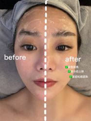 -ST时柒·问题肌抗衰美颜所