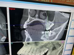 -土豆口腔(凤凰北总店)