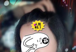 -大麦微针植发全国连锁